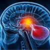 Pituitary Tumor care murrieta ca icon